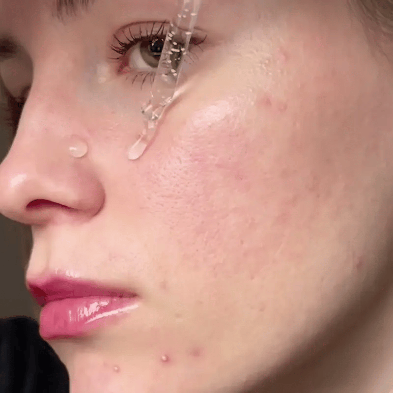 Hello Serum Centella | Regenerador de Piel Sensible
