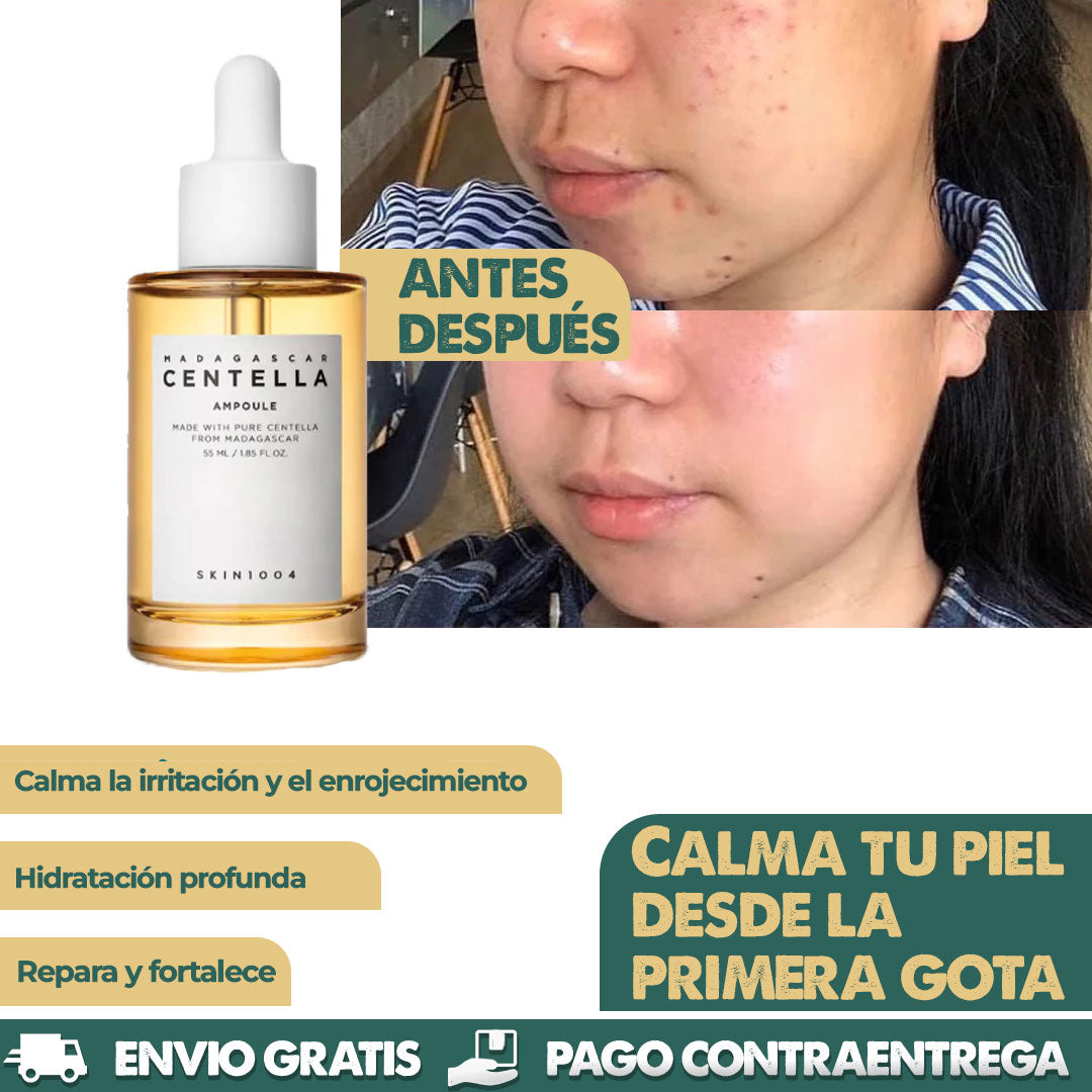 Serum Madagascar | Calma tu piel desde la primera gota