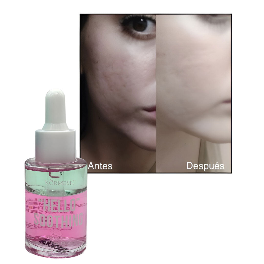 Hello Serum Centella | Regenerador de Piel Sensible