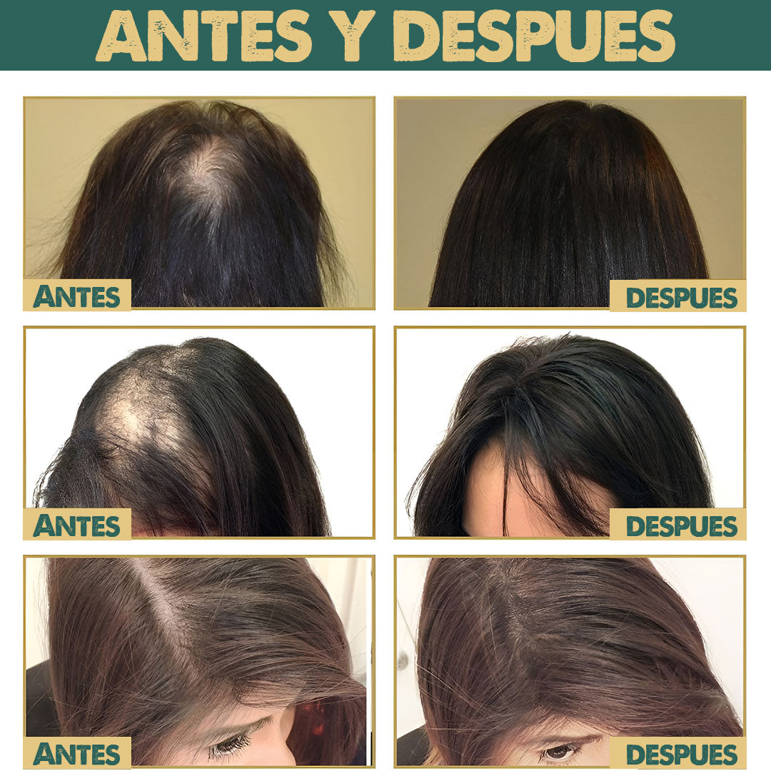 HairBoost Pro| Crecimiento y fortalecimiento capilar desde la primera semana