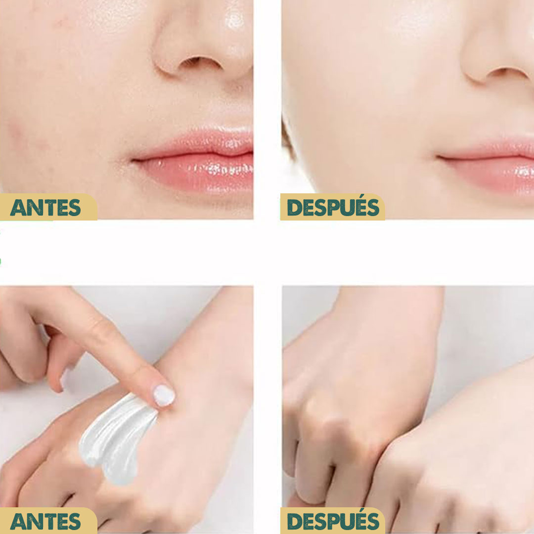 Eelhoe Retinol | Crema Blanqueadora Natural
