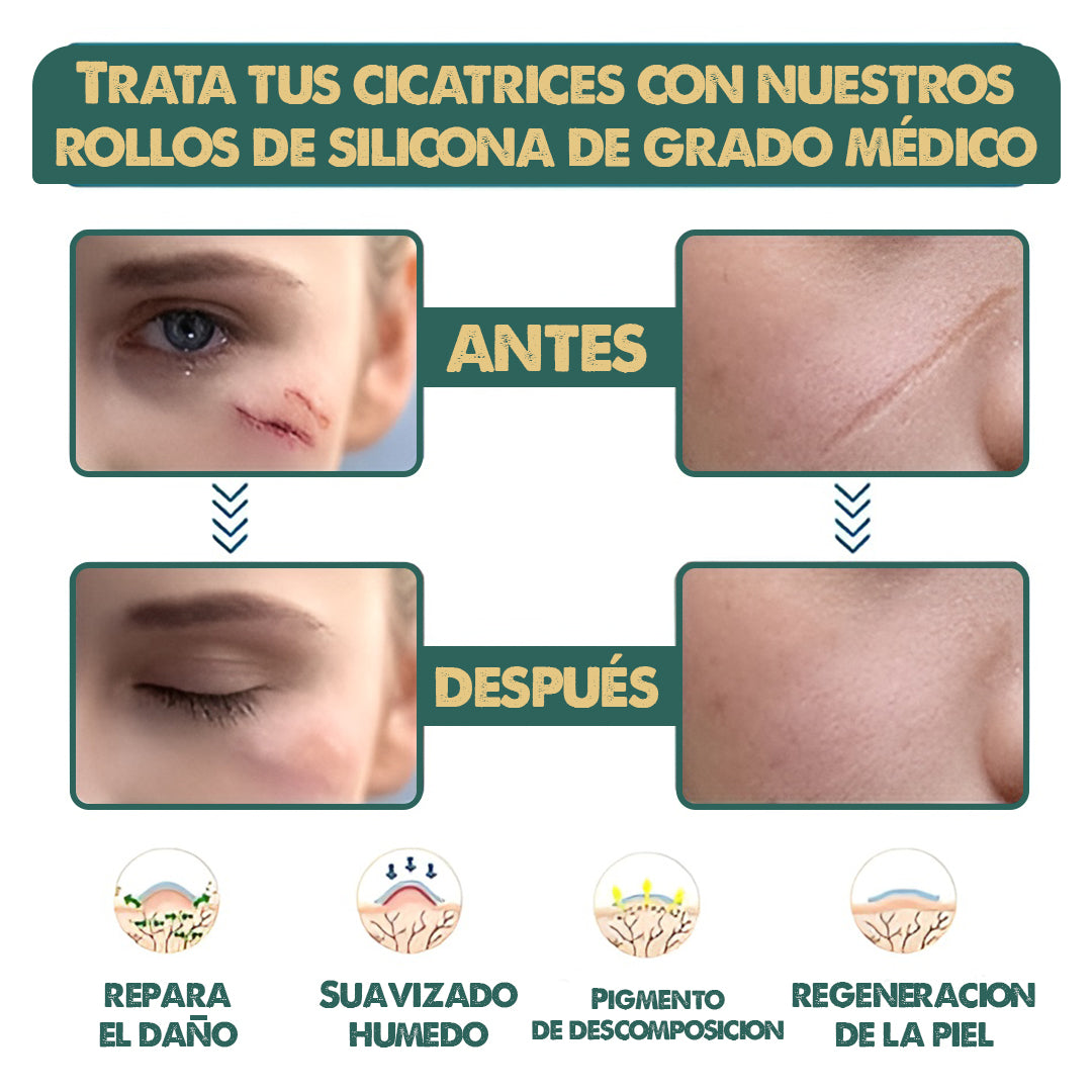 Silicone Scars Sheet | Dile adiós a las cicatrices en semanas!