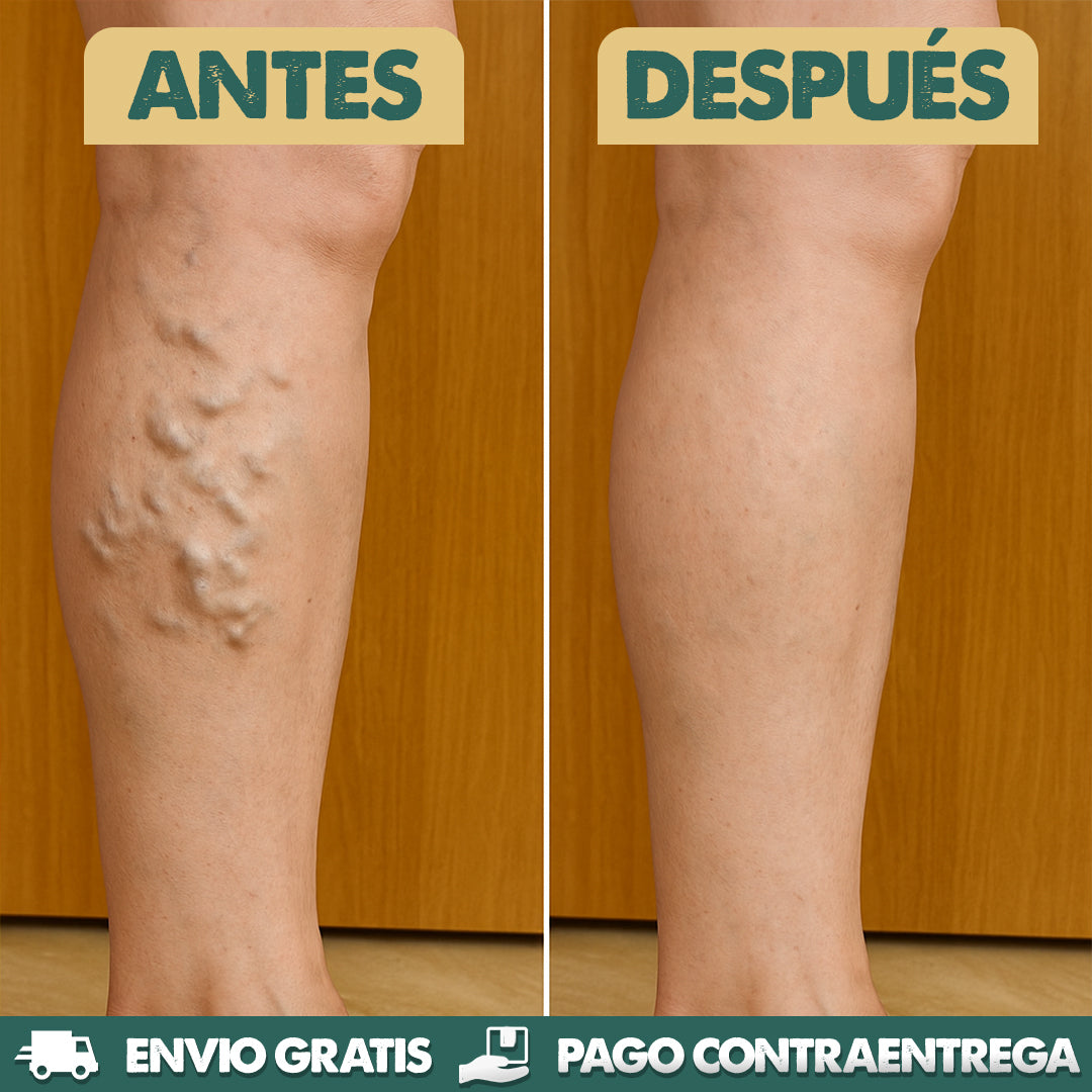 Liposomal Vitamin C - Mejora circulación y varices