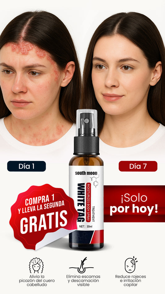 SPRAY WHITE TAG | ELIMINA LA CASPA Y ESCAMACIÓN