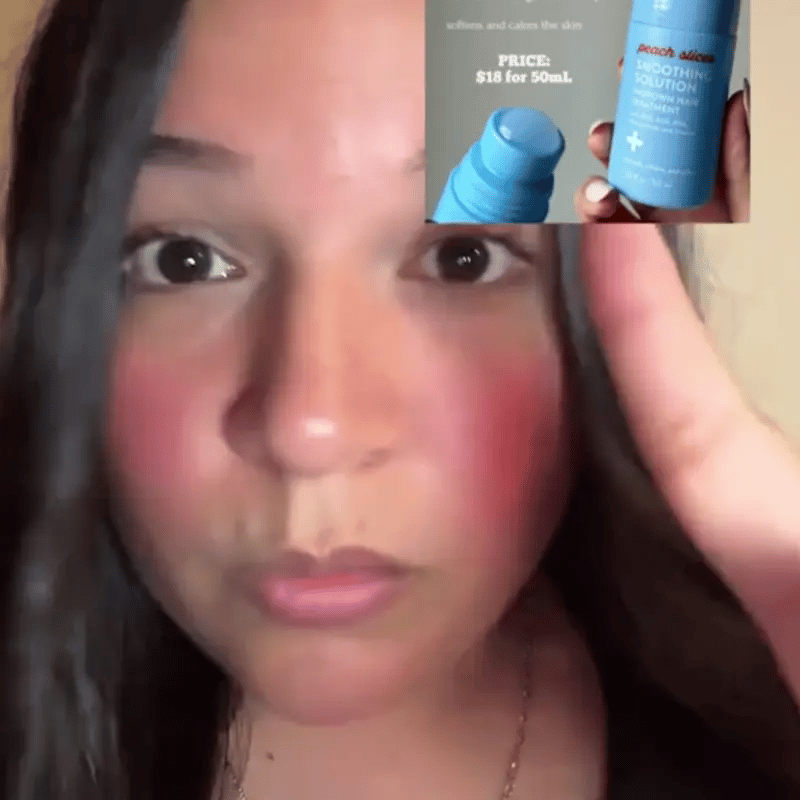 PEACH SLICES ROLLON - Dile adiós a los vellos encarnados