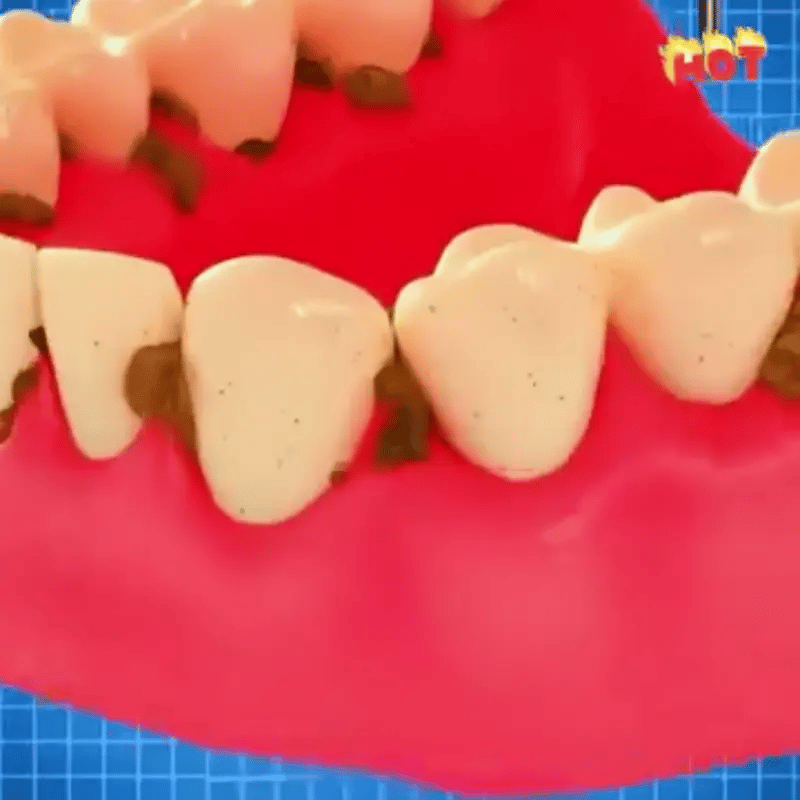 SmilePro 360 - Blanqueador Dental Instantáneo