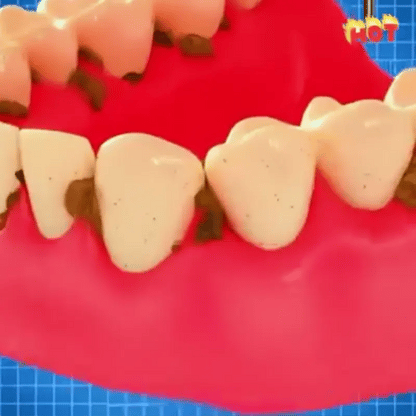 SmilePro 360 - Blanqueador Dental Instantáneo
