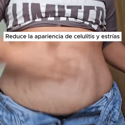 ADEUS - Adios a la celulitis y piel flácida