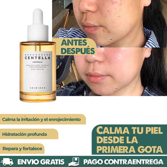 Serum Madagascar | Calma tu piel desde la primera gota
