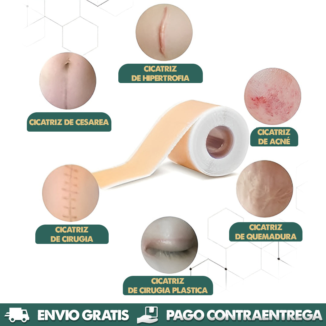 Silicone Scars Sheet | Dile adiós a las cicatrices en semanas