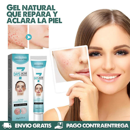 7 Days Acne Removal - Obten una Piel Sana y Lisa