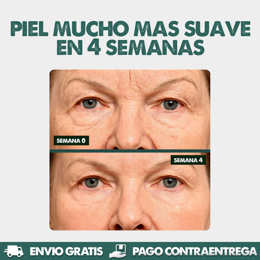 Silicone Marks Sheet | Elimina líneas de expresión