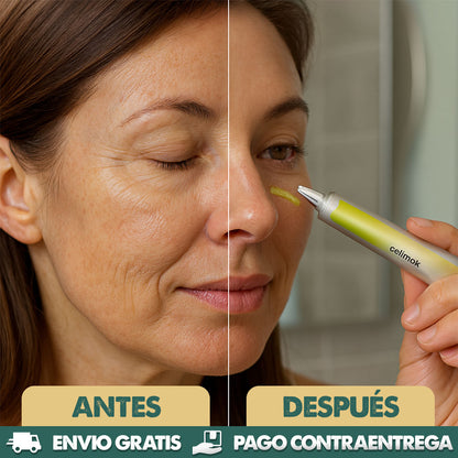 Retinal Shot | Rejuvenece tu piel