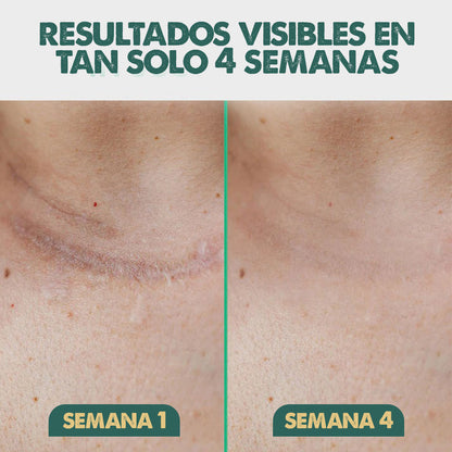 SilicSkin Pro | Suavizante de líneas de expresión