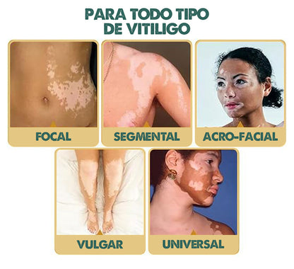 Pigmenta Vita – Revitalización Natural de la Piel