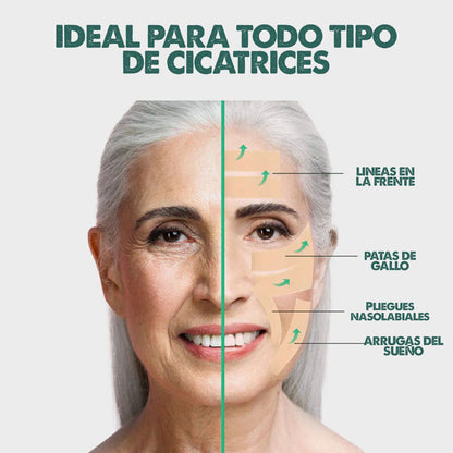 SilicSkin Pro | Suavizante de líneas de expresión