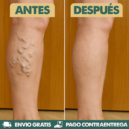 Liposomal Vitamin C - Mejora circulación y varices