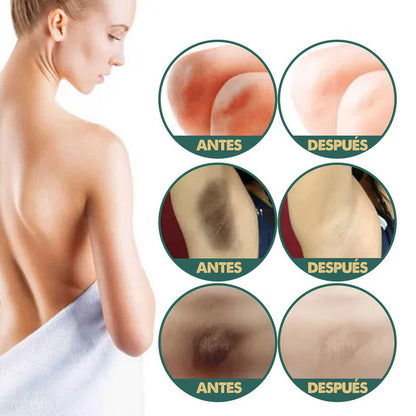 Eelhoe Retinol | Crema Blanqueadora Natural