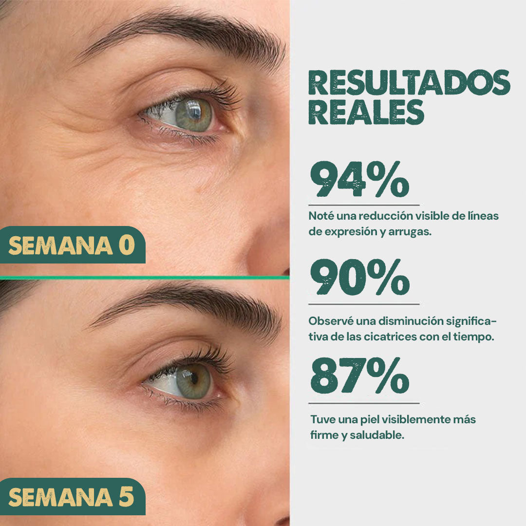 SilicSkin Pro | Suavizante de líneas de expresión
