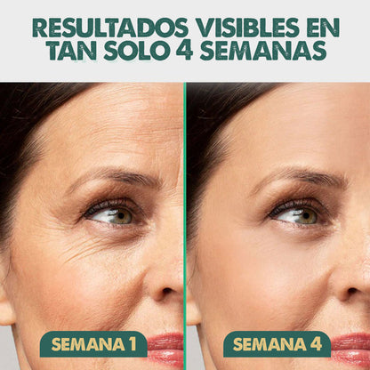 SilicSkin Pro | Suavizante de líneas de expresión